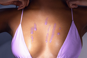 My $60 Boob Lift: All Perks, No Pain