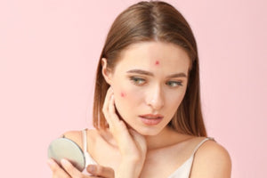 The Ingredients In your Skincare That Could Be Causing Breakouts