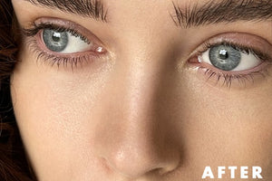 The Science of Pore Shrinking