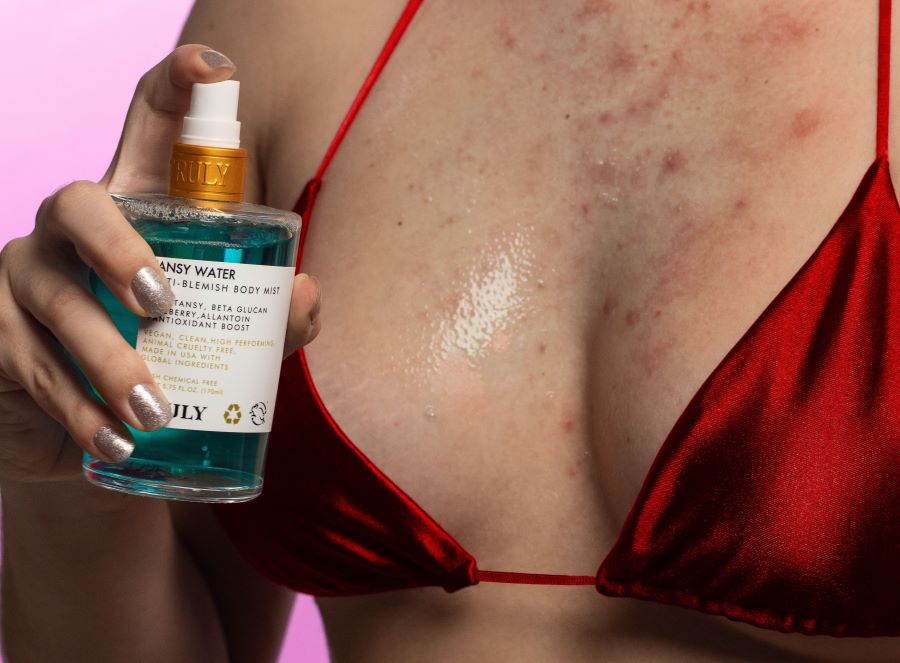 How to Get Rid of Boob Acne
