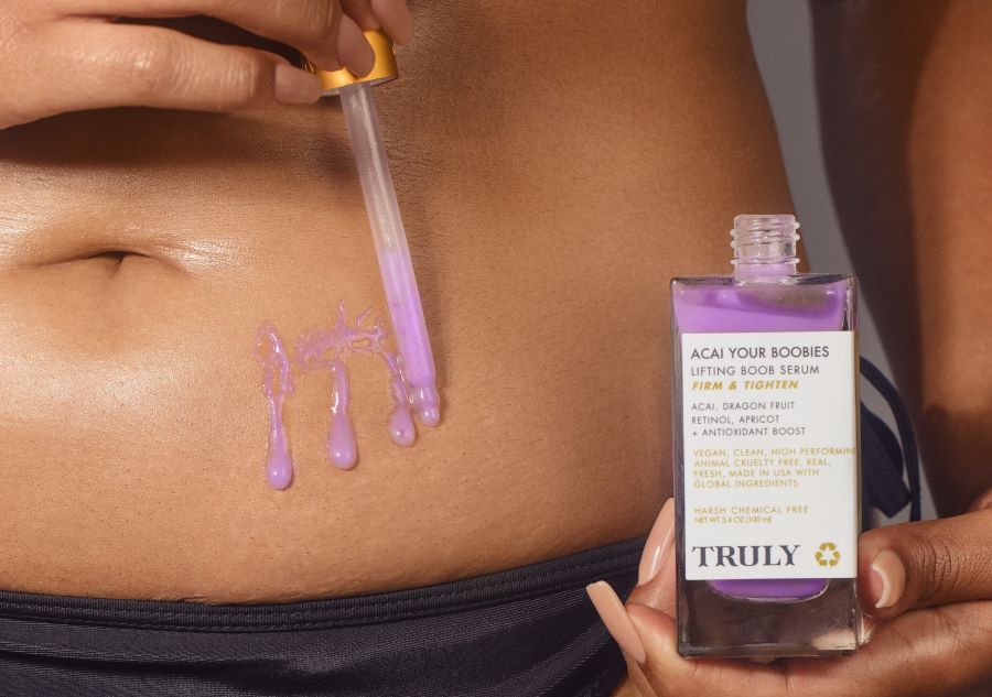 How to Prevent Stretch Marks