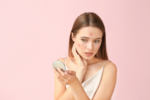 Why Am I Getting Zits… As an Adult?
