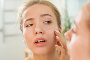 The No-No Ingredient for Dry Skin