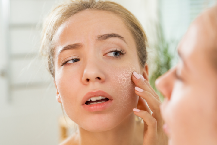 The No-No Ingredient for Dry Skin