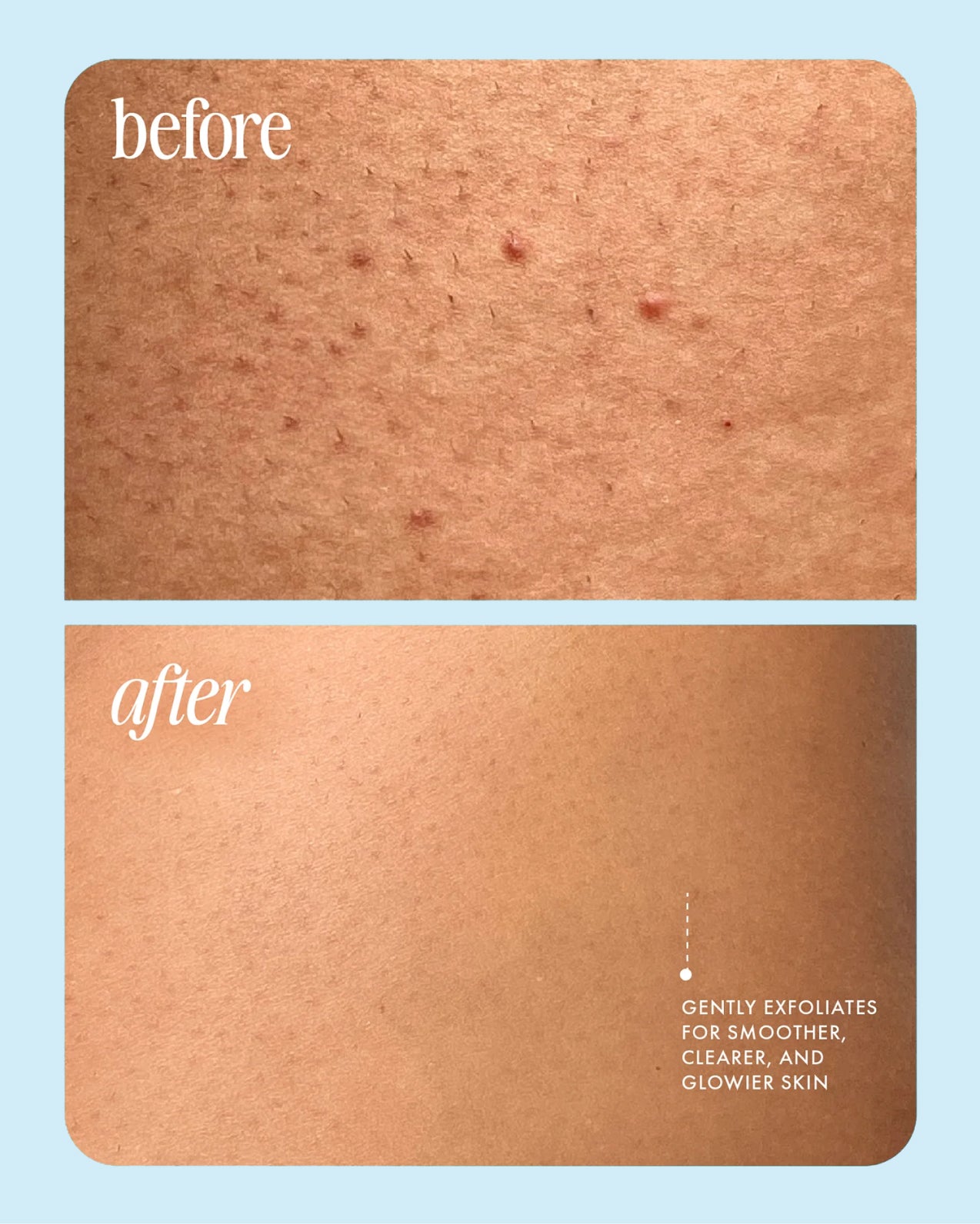 before_after